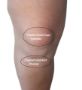 Picture of Knee Strap